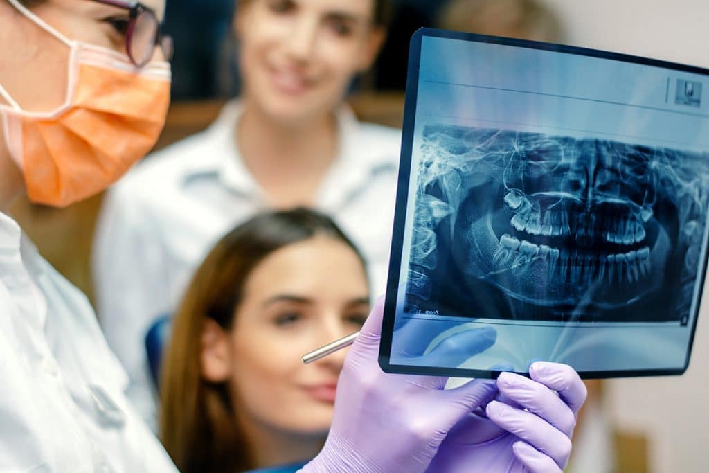 What You Should Know About Dental X-Rays